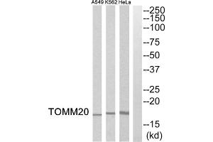 Western blot analysis of extracts from HeLa cells, K562 cells and A549 cells, using TOMM20 antibody. (TOMM20 Antikörper  (Internal Region))
