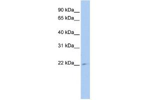 WB Suggested Anti-TUSC1 Antibody Titration: 0. (TUSC1 Antikörper  (Middle Region))
