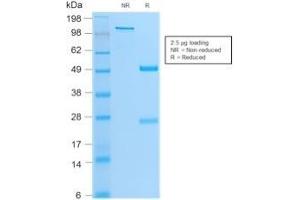 SDS-PAGE Analysis Purified MyoD1 Mouse Monoclonal Antibody (MYOD1/2075R). (Rekombinanter MYOD1 Antikörper)