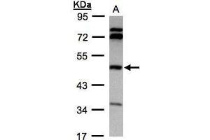 WB Image Sample(30 ug whole cell lysate) A:Hep G2 , 10% SDS PAGE antibody diluted at 1:1000 (BHMT Antikörper)