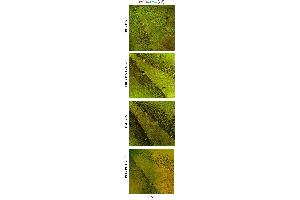 Immunofluorescence (Paraffin-embedded Sections) (IF (p)) image for anti-SRY (Sex Determining Region Y)-Box 2 (SOX2) antibody (ABIN2855074)