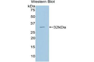 Detection of DGKa in Recombinant Diacylglycerol Kinase Alpha, Rat using Polyclonal Antibody to Diacylglycerol Kinase Alpha (DGKa) (DGKA Antikörper  (AA 312-557))