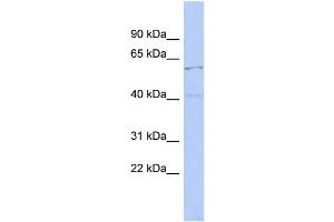 WB Suggested Anti-ZNF384 Antibody Titration: 0. (ZNF384 Antikörper  (Middle Region))