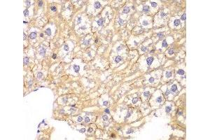 Immunohistochemistry of paraffin-embedded Mouse liver using PPP2R2A Polyclonal Antibody at dilution of 1:100 (40x lens). (PPP2R2A Antikörper)