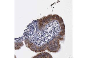Immunohistochemical staining (Formalin-fixed paraffin-embedded sections) of human fallopian tube shows membranous and cytoplasmic positivity in glandular cells with CRKL polyclonal antibody . (CrkL Antikörper  (AA 125-301))