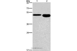 Western blot analysis of Mouse stomach and brain tissue, using DMRT3 Polyclonal Antibody at dilution of 1:550 (DMRT3 Antikörper)