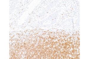 Immunohistochemistry (IHC) image for anti-CD247 Molecule (CD247) (C-Term) antibody (ABIN7454039) (Rekombinanter CD247 Antikörper  (C-Term))