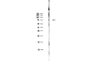 anti-V-Raf-1 Murine Leukemia Viral Oncogene Homolog 1 (RAF1) (pSer259) antibody