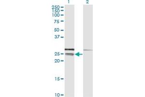 Western Blot analysis of CD99 expression in transfected 293T cell line by CD99 monoclonal antibody (M01), clone 3A10. (CD99 Antikörper  (AA 23-122))