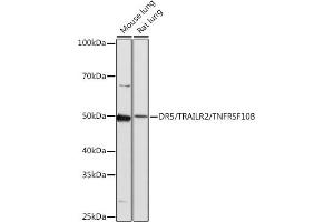 Western Blotting (WB) image for anti-Tumor Necrosis Factor Receptor Superfamily, Member 10b (TNFRSF10B) antibody (ABIN7271062)