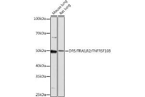 Western blot analysis of extracts of various cell lines, using DR5/TR/TNFRSF10B antibody (ABIN7271062) at 1:1000 dilution. (TNFRSF10B Antikörper)