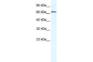 WB Suggested Anti-DDX21 Antibody Titration:  1. (DDX21 Antikörper  (C-Term))