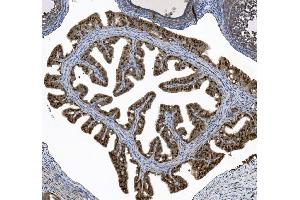 IHC analysis of FOXJ1 using anti-FOXJ1 antibody (ABIN7601015).
