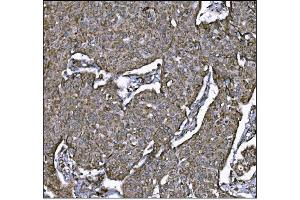IHC analysis of LRP1B using anti-LRP1B antibody (ABIN7601521). (LRP1B Antikörper  (AA 3704-4547))