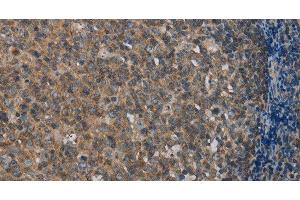 Immunohistochemistry of paraffin-embedded Human tonsil using MMP20 Polyclonal Antibody at dilution of 1:40 (MMP20 Antikörper)