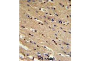 Immunohistochemistry (IHC) image for anti-Tumor Protein P73 (TP73) antibody (ABIN3003949) (Tumor Protein p73 Antikörper)