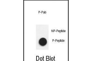 Dot blot analysis of anti-Phospho-Nephrin  antibody Phospho-specific Pab (ABIN650883 and ABIN2839826) on nitrocellulose membrane. (Nephrin Antikörper  (pTyr1193))