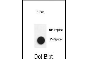 Dot blot analysis of anti-Phospho-Nephrin  antibody Phospho-specific Pab (ABIN650883 and ABIN2839826) on nitrocellulose membrane. (Nephrin Antikörper  (pTyr1193))