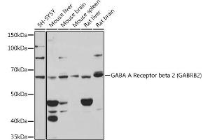 Western blot analysis of extracts of various cell lines, using GABA A Receptor beta 2 (G) (G) Rabbit mAb (ABIN7267342) at 1:1000 dilution. (GABRB2 Antikörper)