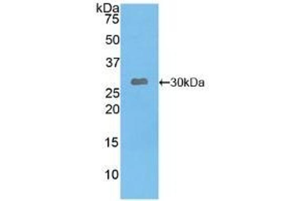 Leptin Receptor Antikörper  (AA 310-539)