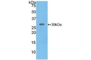 Leptin Receptor antibody  (AA 310-539)