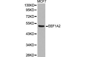 Western blot analysis of extracts of MCF7 cell line, using EEF1A2 antibody. (EEF1A2 Antikörper)