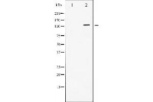 Western blot analysis of STAT2 phosphorylation expression in IFN treated HeLa whole cell lysates,The lane on the left is treated with the antigen-specific peptide. (STAT2 Antikörper  (pTyr690))