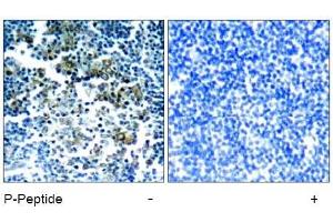 Image no. 1 for anti-Breakpoint Cluster Region (BCR) (pTyr177) antibody (ABIN196938) (BCR Antikörper  (pTyr177))