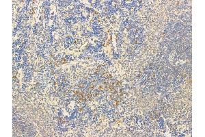 ABIN6256292 and ABIN6267069 at 1/100 staining Rat spleen tissue by IHC-P.