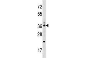 CD68 antibody western blot analysis in MDA-MB453 lysate