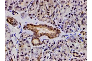 Immunohistochemistry (IHC) image for anti-LIM Domain Kinase 1 (LIMK1) (pThr508) antibody (ABIN6255701)