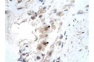 KIAA0494 antibody was used for immunohistochemistry at a concentration of 4-8 ug/ml to stain Decidual cells (arrows) in Human Placenta. (KIAA0494 Antikörper  (N-Term))