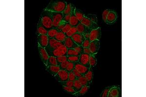 Immunofluorescence (IF) image for anti-Junction Plakoglobin (JUP) antibody (ABIN6939841)