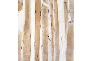 Formalin-Fixed, Paraffin-Embedded human skeletal muscle tissue reacted with Autophagy ATG4A Antibody , which was peroxidase-conjugated to the secondary antibody, followed by DAB staining. (ATG4A Antikörper  (C-Term))