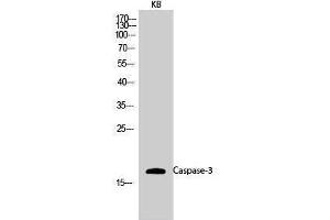 Western Blotting (WB) image for anti-Caspase 3 (CASP3) (Ser1981) antibody (ABIN3179903) (Caspase 3 Antikörper  (Ser1981))