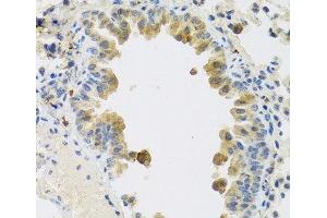 Immunohistochemistry of paraffin-embedded Mouse lung using RSPO1 Polyclonal Antibody at dilution of 1:100 (40x lens). (RSPO1 Antikörper)