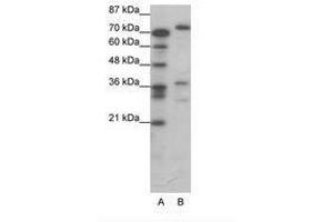 Image no. 1 for anti-CAMP Responsive Element Binding Protein 3 (CREB3) (AA 247-296) antibody (ABIN6736064) (CREB3 Antikörper  (AA 247-296))