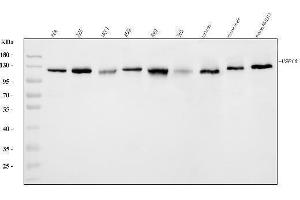 Western blot analysis of USP10 using anti-USP10 antibody (ABIN7599550).