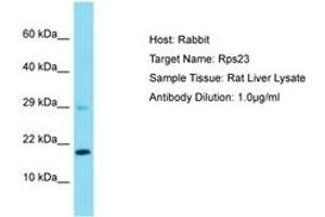 Image no. 1 for anti-Ribosomal Protein S23 (RPS23) (AA 15-64) antibody (ABIN6750515) (RPS23 Antikörper  (AA 15-64))