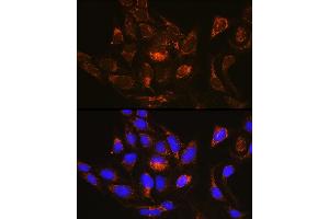 Immunofluorescence analysis of U-2 OS cells using R Rabbit pAb (ABIN6128425, ABIN6146547, ABIN6146548 and ABIN6214868) at dilution of 1:100 (40x lens).