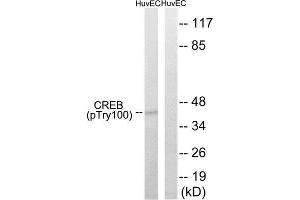 Western Blotting (WB) image for anti-cAMP Responsive Element Binding Protein 1 (CREB1) (pThr100) antibody (ABIN1847546) (CREB1 Antikörper  (pThr100))
