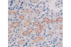 Used in DAB staining on fromalin fixed paraffin- embedded Kidney tissue (ALOX15B Antikörper  (AA 349-633))