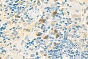 Immunohistochemistry analysis of paraffin-embedded mouse spleen using PPP2R2A (ABIN7075274) at dilution of 1: 2000 (PPP2R2A Antikörper)
