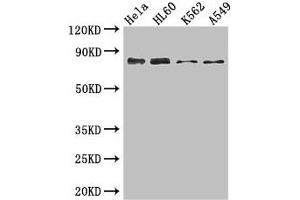 Western Blot Positive WB detected in: Hela whole cell lysate, HL60 whole cell lysate, K562 whole cell lysate, A549 whole cell lysate All lanes: SSRP1 antibody at 3. (SSRP1 Antikörper  (AA 1-242))
