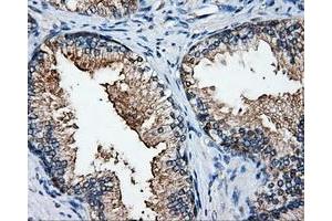 Immunohistochemical staining of paraffin-embedded Kidney tissue using anti-ELAVL1mouse monoclonal antibody. (ELAVL1 Antikörper)