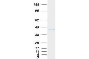 Validation with Western Blot
