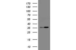 Image no. 1 for anti-Replication Factor C (Activator 1) 2, 40kDa (RFC2) antibody (ABIN1500671) (RFC2 Antikörper)
