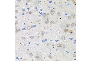 Immunohistochemistry of paraffin-embedded rat brain using GNE antibody. (GNE Antikörper  (AA 1-150))