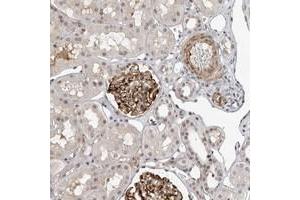 Immunohistochemical staining of human kidney with TRIM66 polyclonal antibody  shows strong cytoplasmic positivity in glomerular cells. (TRIM66 Antikörper)