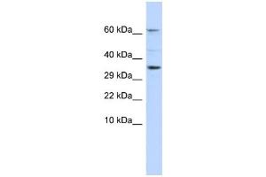 WB Suggested Anti-KCNIP2 Antibody Titration:  0. (KCNIP2 Antikörper  (N-Term))